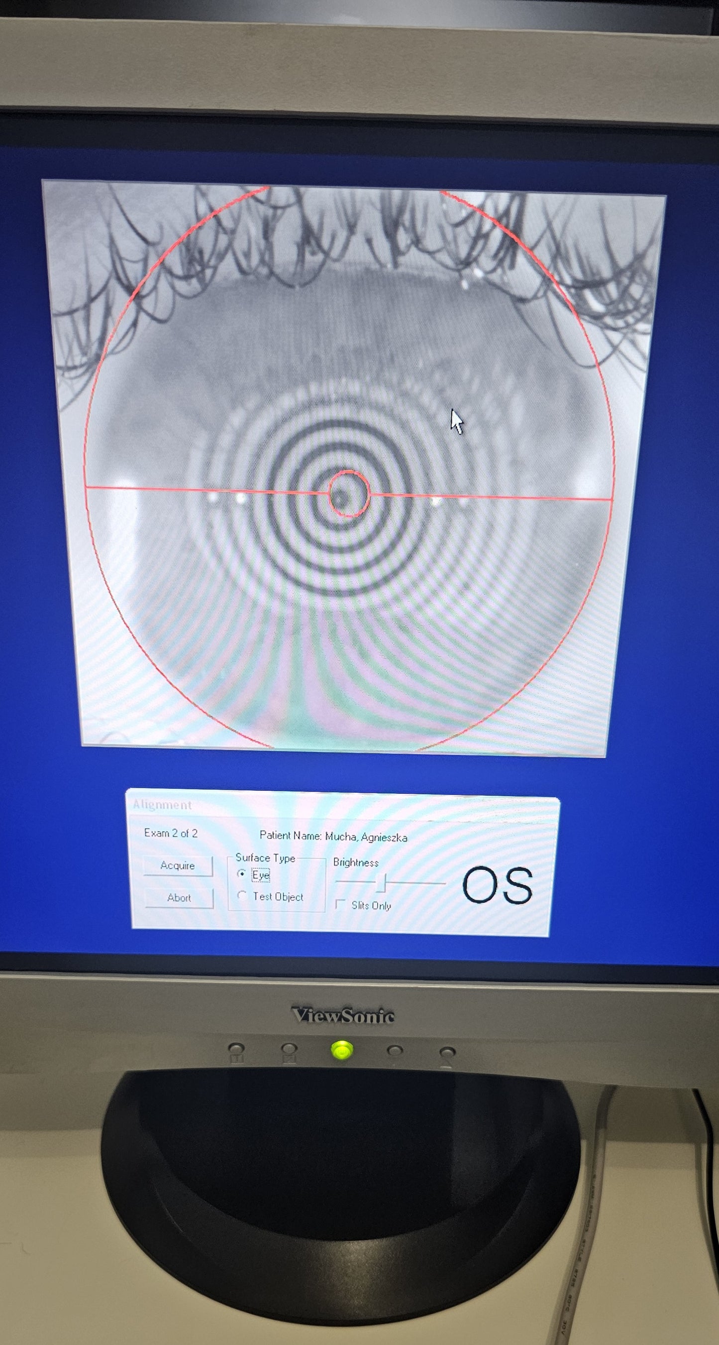 BAUSCH & LOMB ORBSCAN IIz Topographer